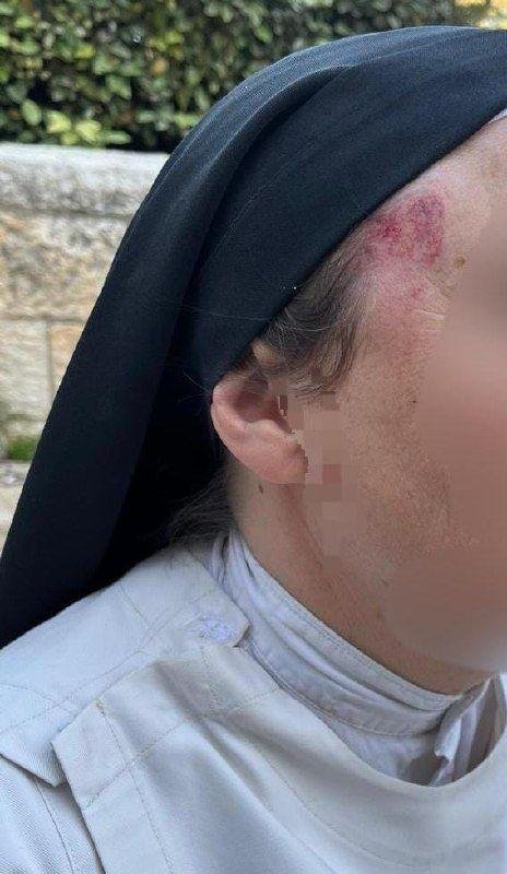 إصابة راهبة باعتداء مستوطن في القدس 